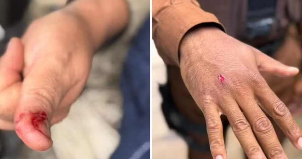 macaco-prego-invade-casas,-ingere-alcool-e-medicamentos-e-deixa-cinco-feridos-em-salvador