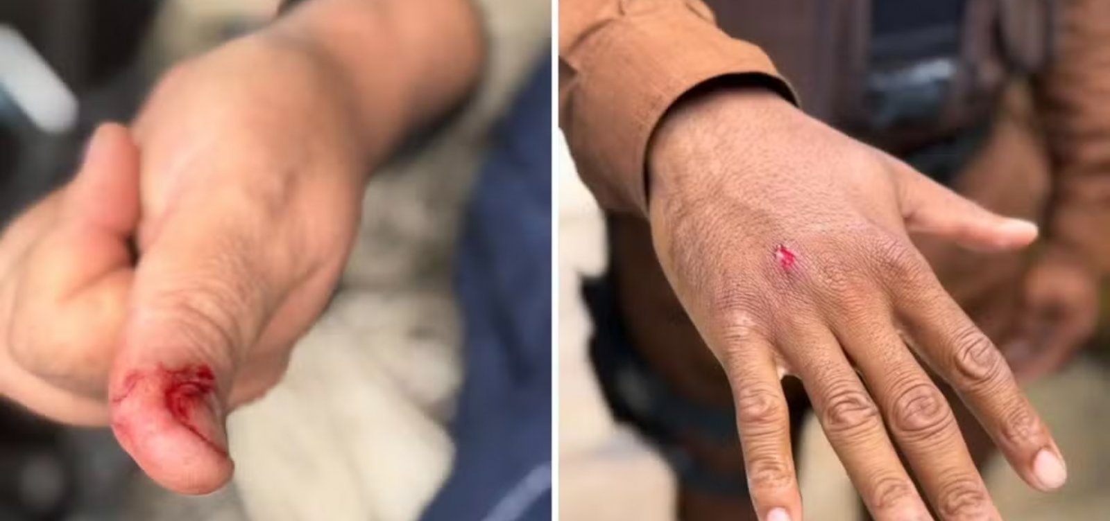 macaco-prego-invade-casas,-ingere-alcool-e-medicamentos-e-deixa-cinco-feridos-em-salvador