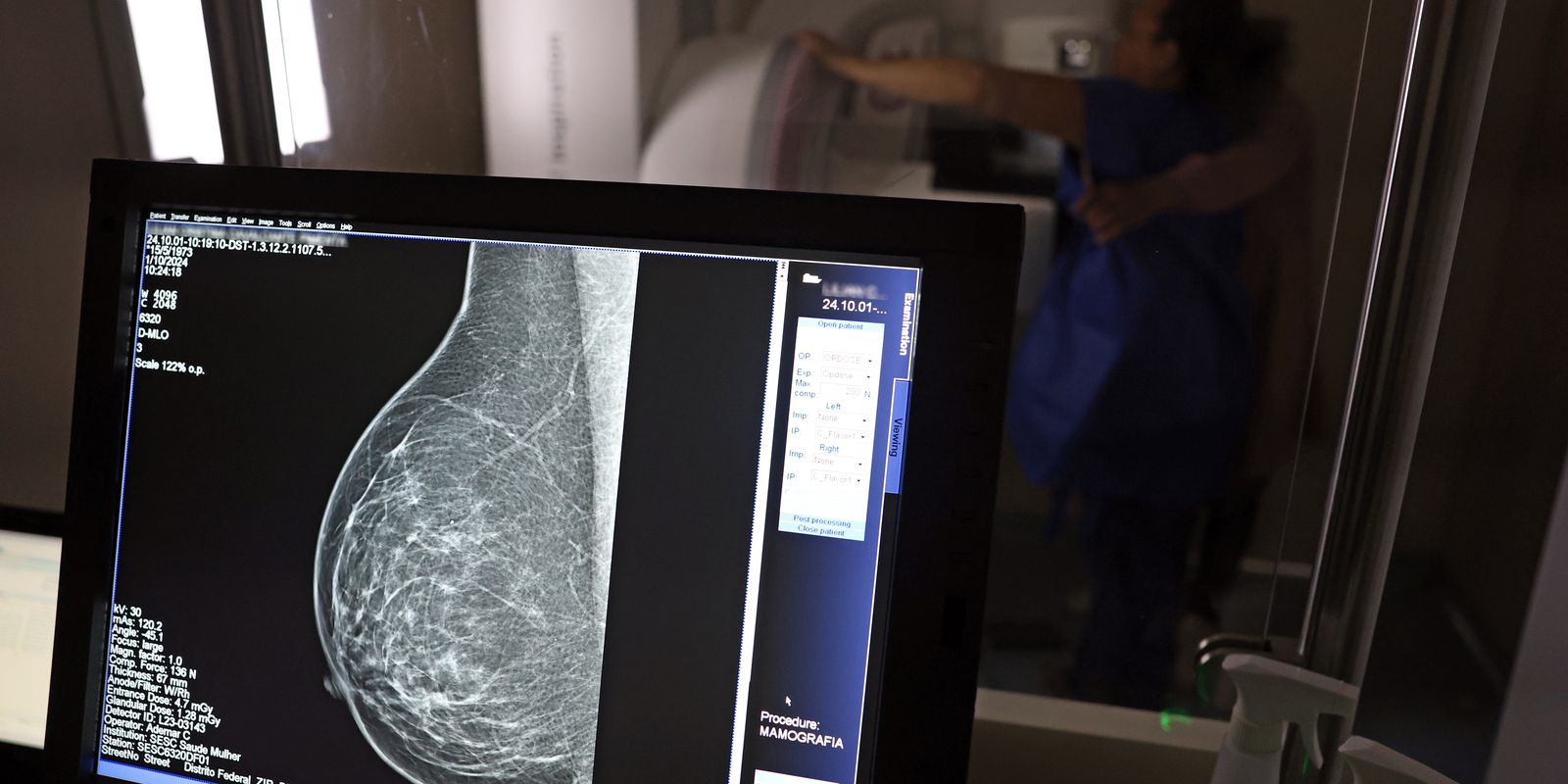viva-maria:-outubro-rosa-alerta-para-prevencao-ao-cancer-de-mama
