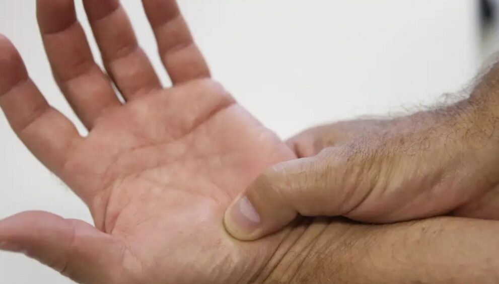 anvisa-libera-nova-opcao-de-medicamento-para-adultos-com-lupus