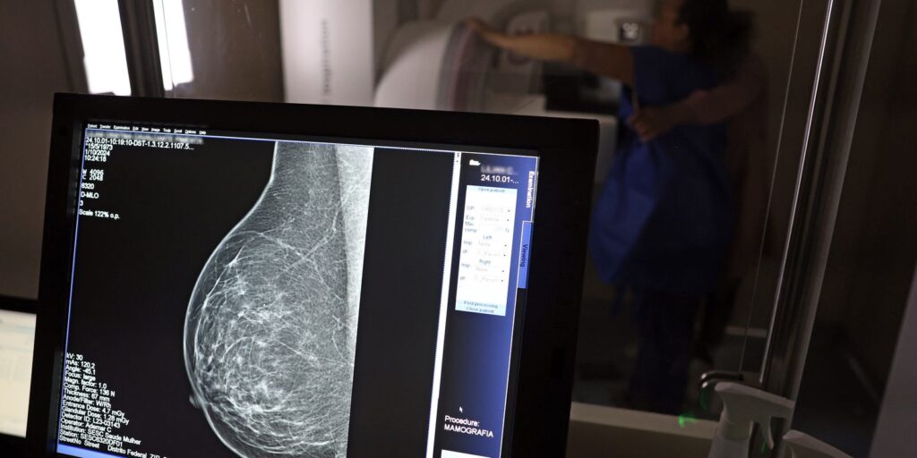 cancer-de-mama:-diagnostico-precoce-amplia-chance-de-cura