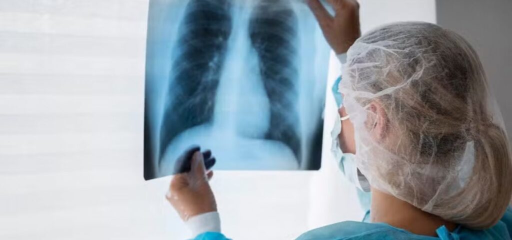 anvisa-aprova-novo-medicamento-para-cancer-de-pulmao